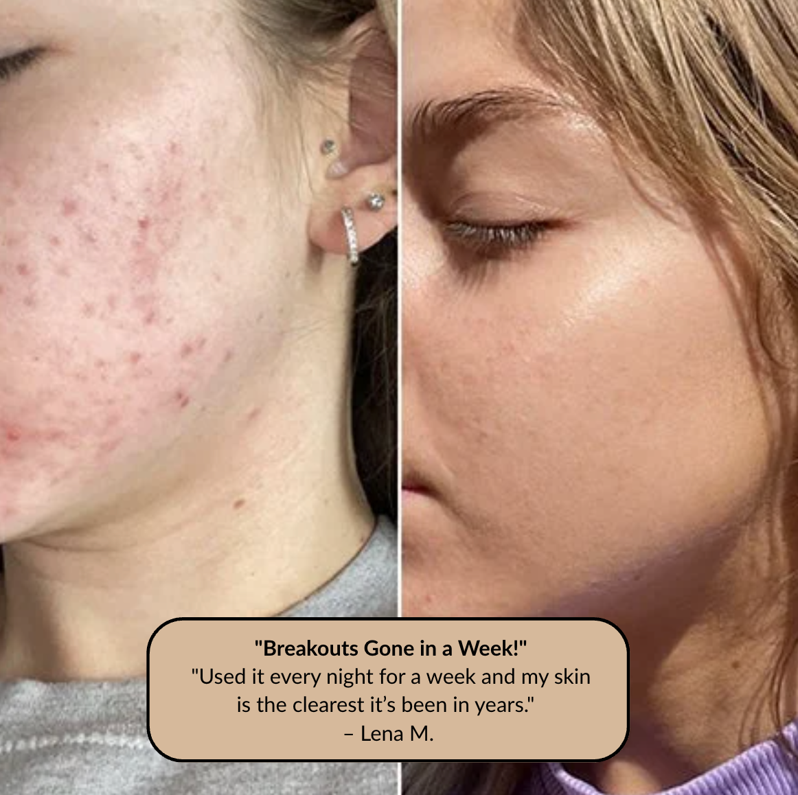 The At-Home Facial That Clears, Lifts, and Glows