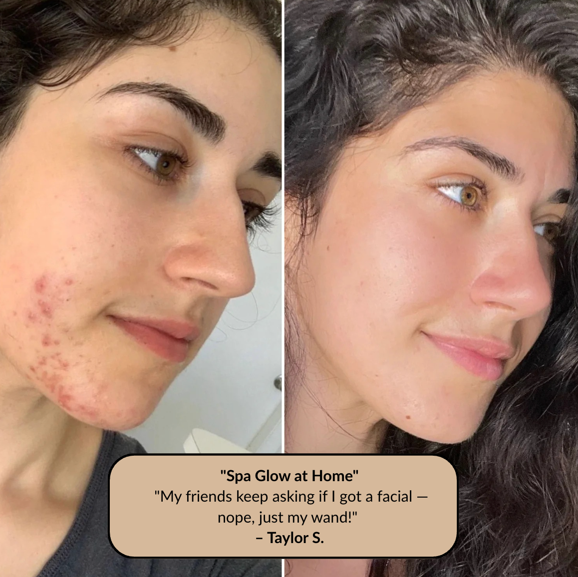 The At-Home Facial That Clears, Lifts, and Glows