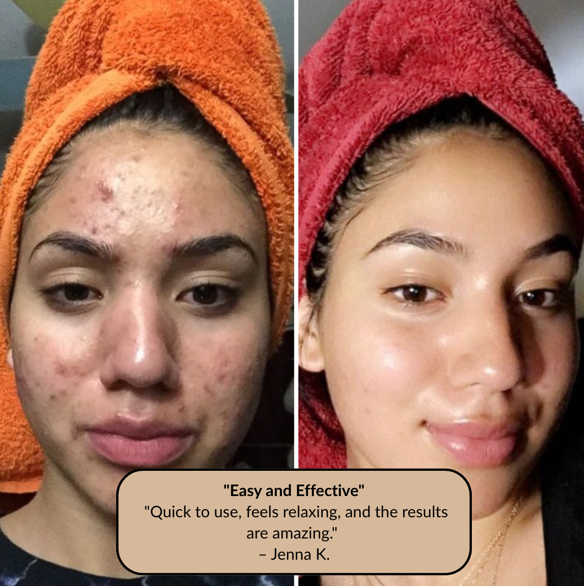 The At-Home Facial That Clears, Lifts, and Glows