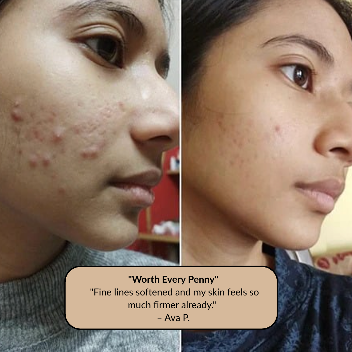 The At-Home Facial That Clears, Lifts, and Glows